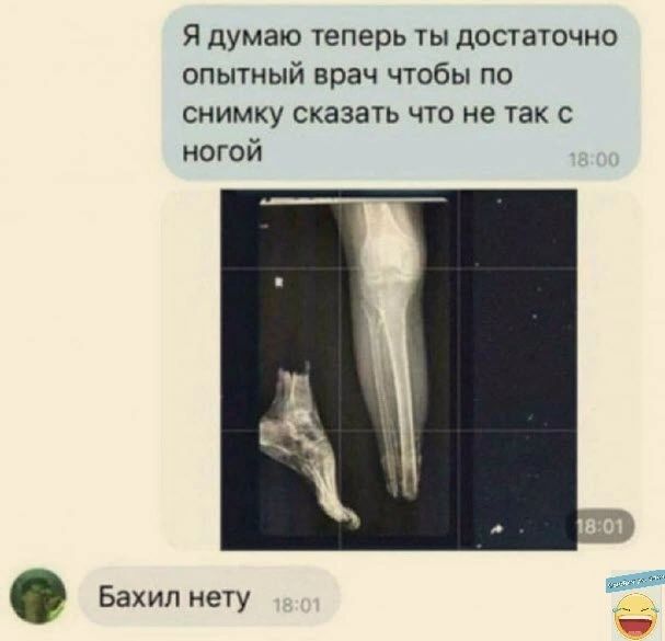 Я думаю теперь ты достаточно опытный врач чтобы по снимку сказать что не так с ногой