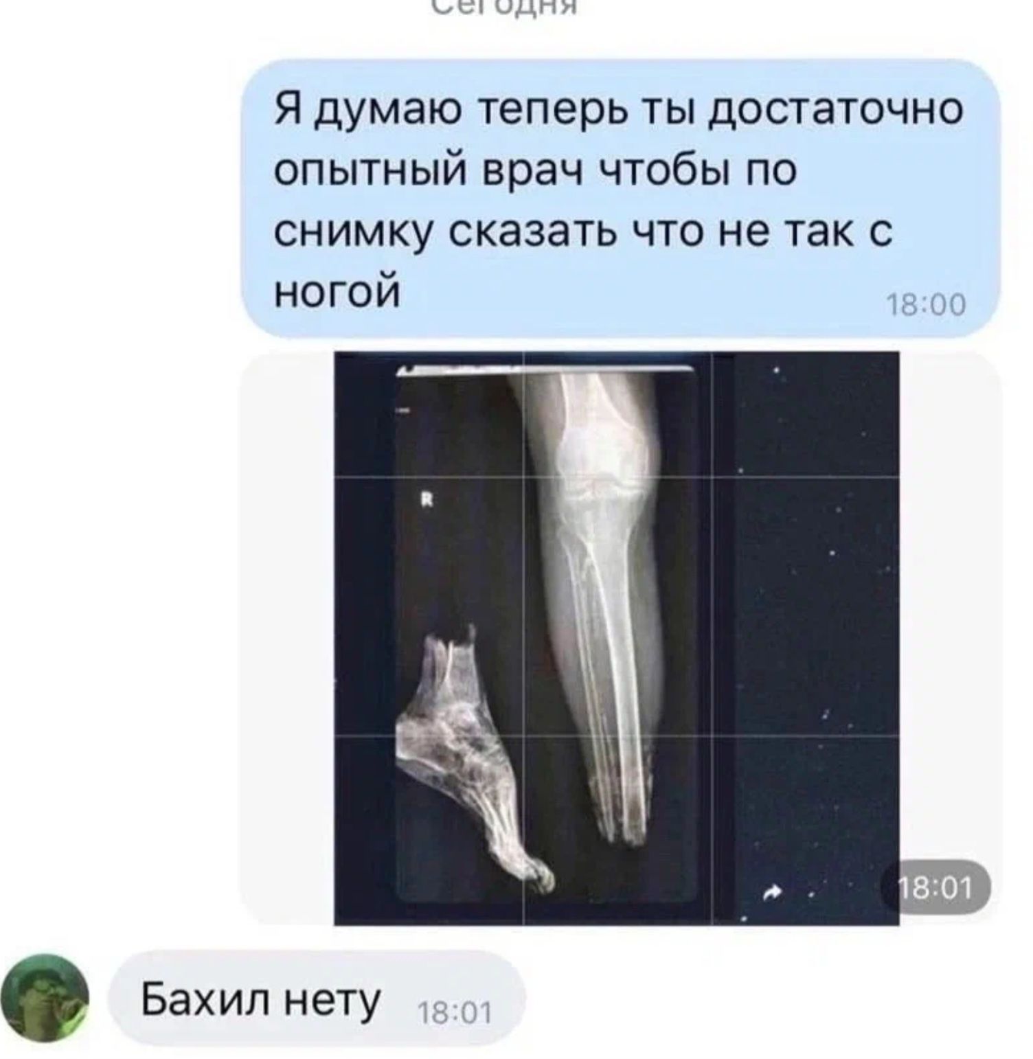 Я думаю ТЕПЕРЬ ТЫ ДОСТЕТОЧНО опытный врач чтобы по СНИМКУ СКЗЗЭТЬ ЧТО не ТВК С ногой