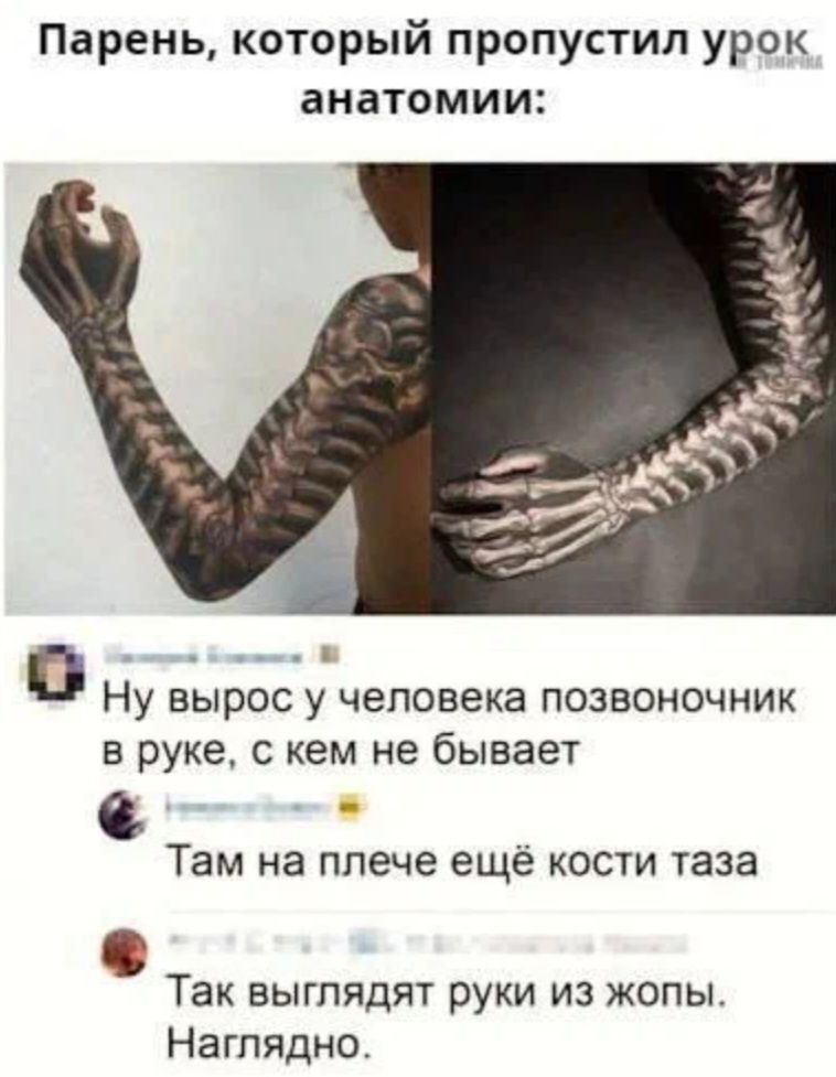 Парень который пропустил урок анатомии 0 Ну вырос у человека позвоночник в руке кем не бывает С Там на плече ещё кости таза Так выглядят руки из жопы Наглядно