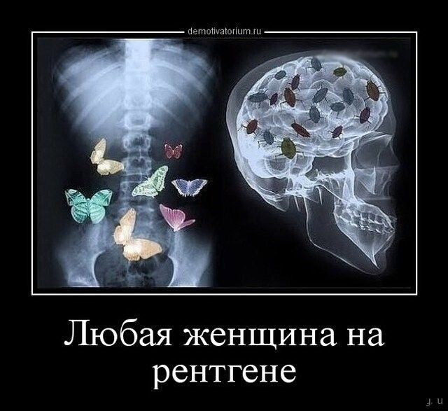 Любая женщина на рентгене