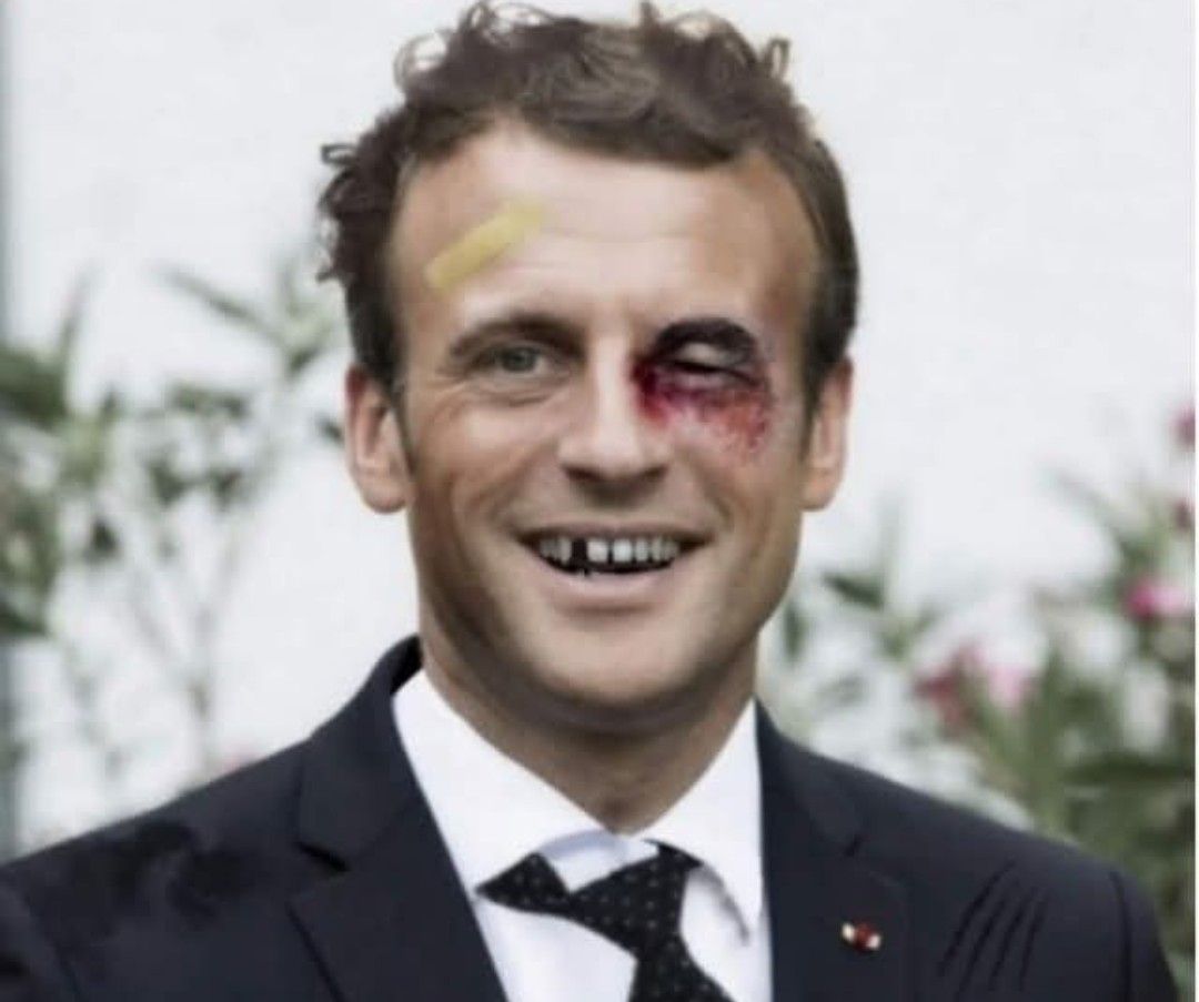 Фото политического деятеля с синяком на лице