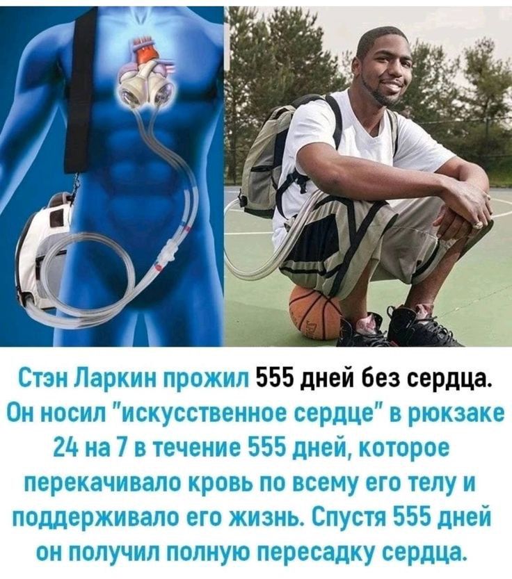 Сп носып схчссчце юг серные в р_ каге 211 7 5 тсчсчас 555 гг оюрщ попе згпо рззь по иса с его тегу и погдзр что его з Спус о сдучнп полную пересадку с