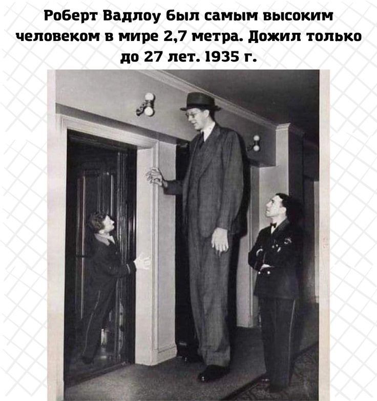 РоБерт Надпоу Был самым высоким человеком в пиве 27 метра дожил только до 27 лет 935 г