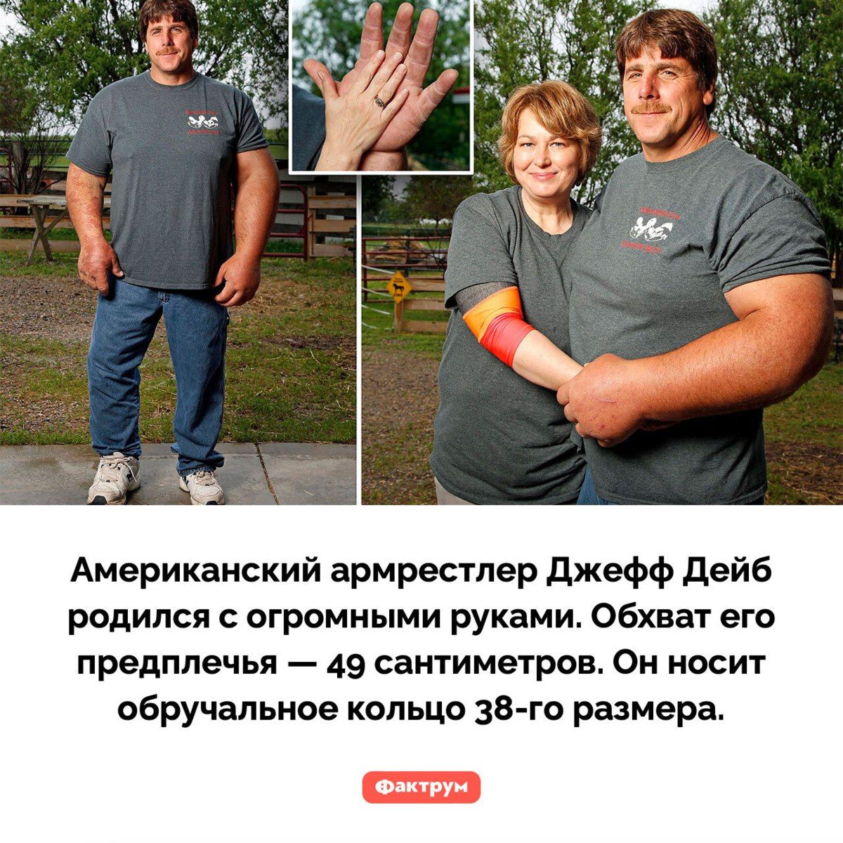 Американский армрестлер Джефф Дейб родился с огромными руками. Обхват его предплечья — 49 сантиметров. Он носит обручальное кольцо 38-го размера.