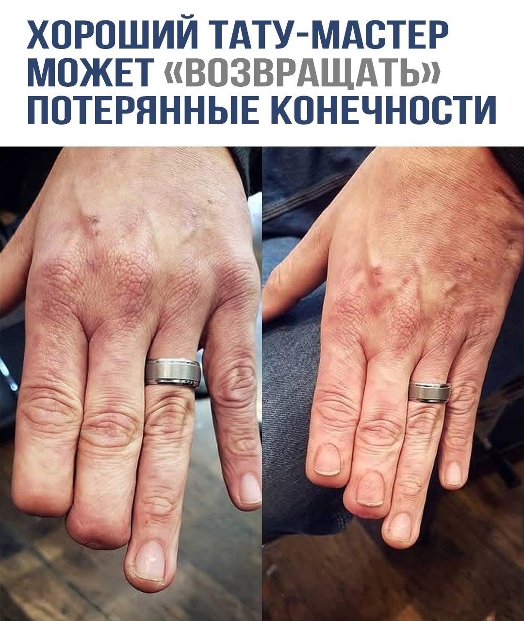 ХОРОШИЙ ТАТУ-МАСТЕР МОЖЕТ «ВОЗВРАЩАТЬ» ПОТЕРЯННЫЕ КОНЕЧНОСТИ