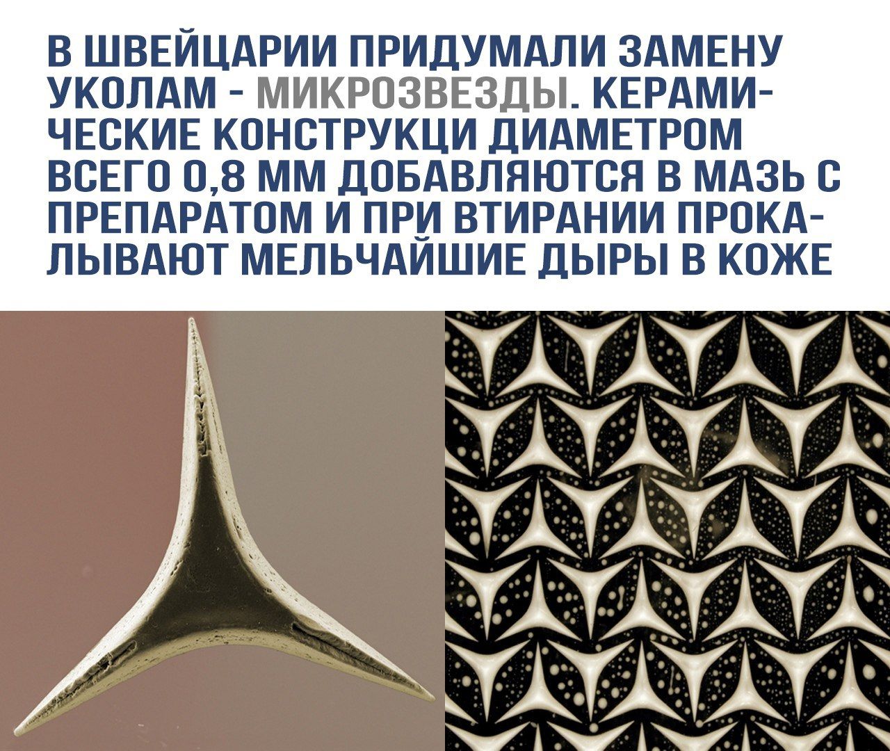 В Швейцарии придумали замену уколам - микрозвёзды. Керамические конструкции диаметром всего 0,8 мм добавляются в мазь с препаратом и при втирании прокалывают мельчайшие дыры в коже.