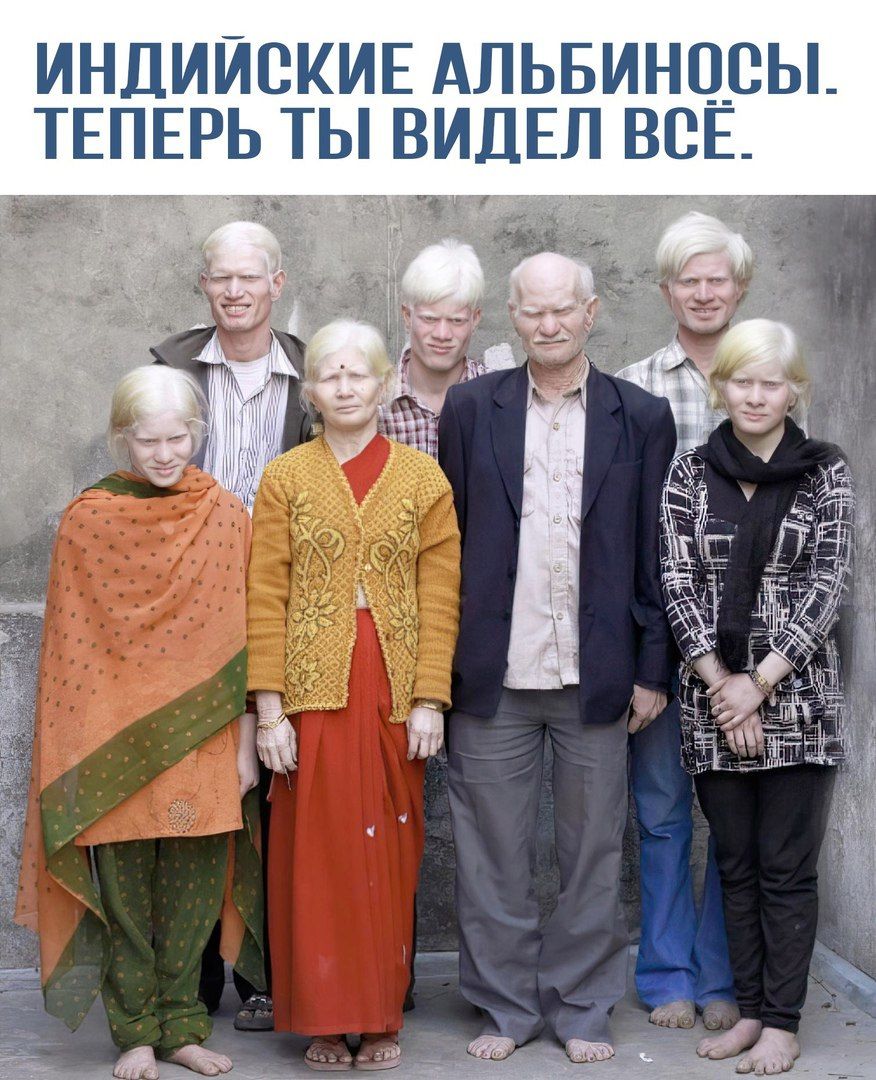 ИНДИЙСКИЕ АЛЬБИНОСЫ. ТЕПЕРЬ ТЫ ВИДЕЛ ВСЁ.
