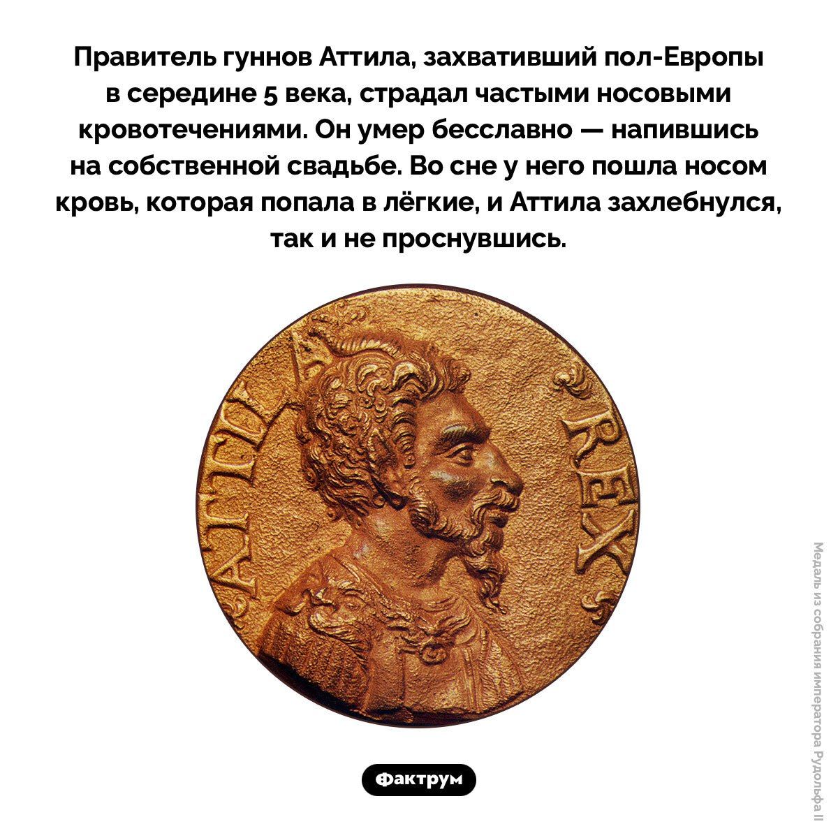 Правитель гуннов Аттила, захвативший пол-Европы в середине 5 века, страдал частыми носовыми кровотечениями. Он умер бесславно — напившись на собственной свадьбе. Во сне у него пошла носом кровь, которая попала в лёгкие, и Аттила захлебнулся, так и не проснувшись.
