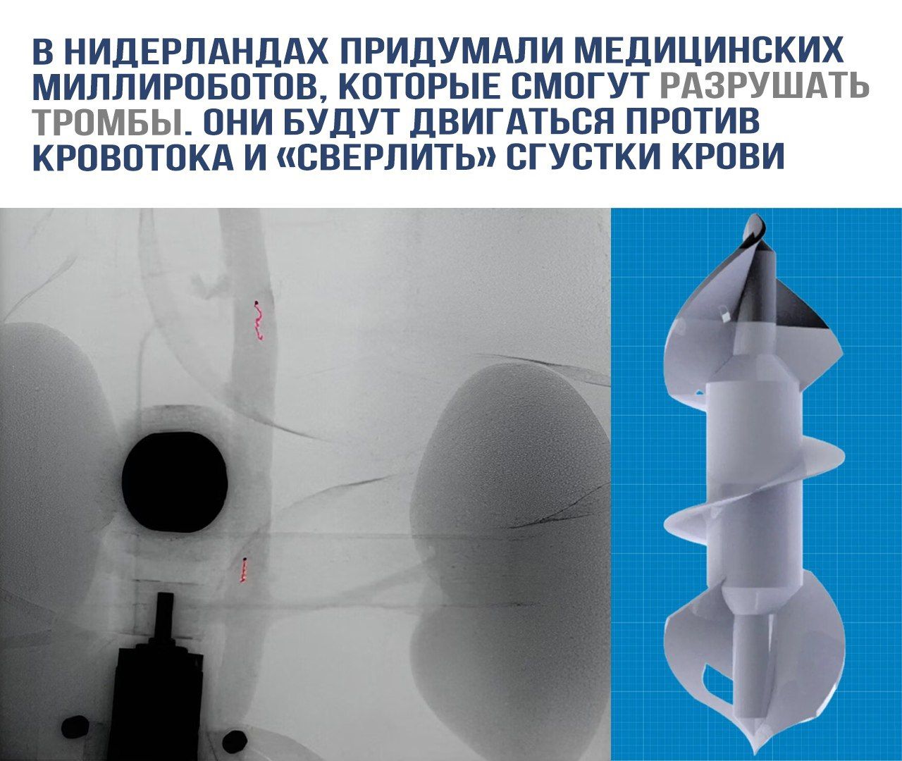 В Нидерландах придумали медицинских миллироботов, которые смогут разрушать тромбы. Они будут двигаться против кровотока и «сверлить» густики крови.