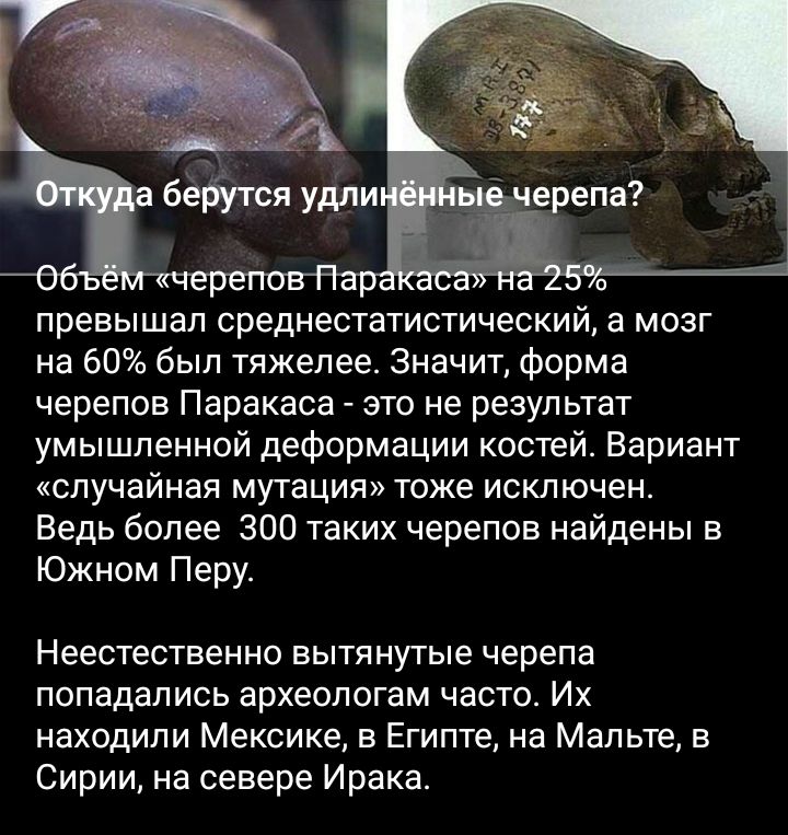 превышал среднестатистически а мозг не 60 был тяжелее Значит форма черепов Паракаса это не результат умышленной деформации костей Вариант случайная мутация тоже исключен Ведь более 300 таких черепов найдены в Южном Перу Неестественно вытянутые черепа попадались археологам часто Их находили Мексике в Египте на Мальте в Сирии на севере Ирака