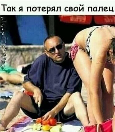 Так я потерял свой палец
