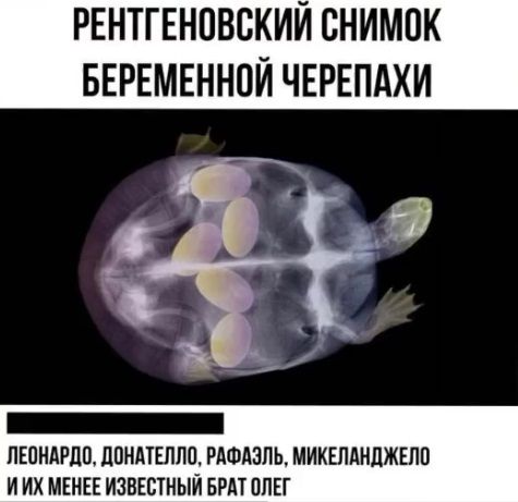 РЕНТГЕНОВЕКИЙ ВНИМОК БЕРЕМЕННПЙ ЧЕРЕПАХИ ПЕПИАРПП ЦПНАТШПП РАФАЭЛЬ МИКШАИПЖЕЛО И ИХ МЕНЕЕ ИЗВЕСТНЫИ БРАТ ОЛЕГ