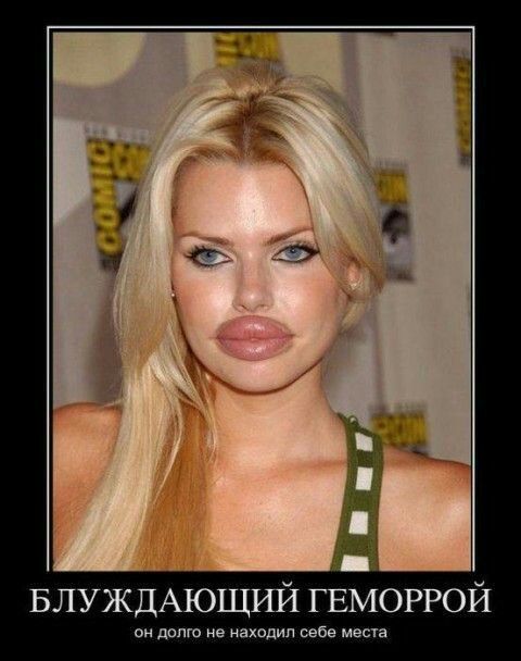 БЛУЖДАЮЩИЙ ГЕМОРРОЙ
он долго не находил себе места