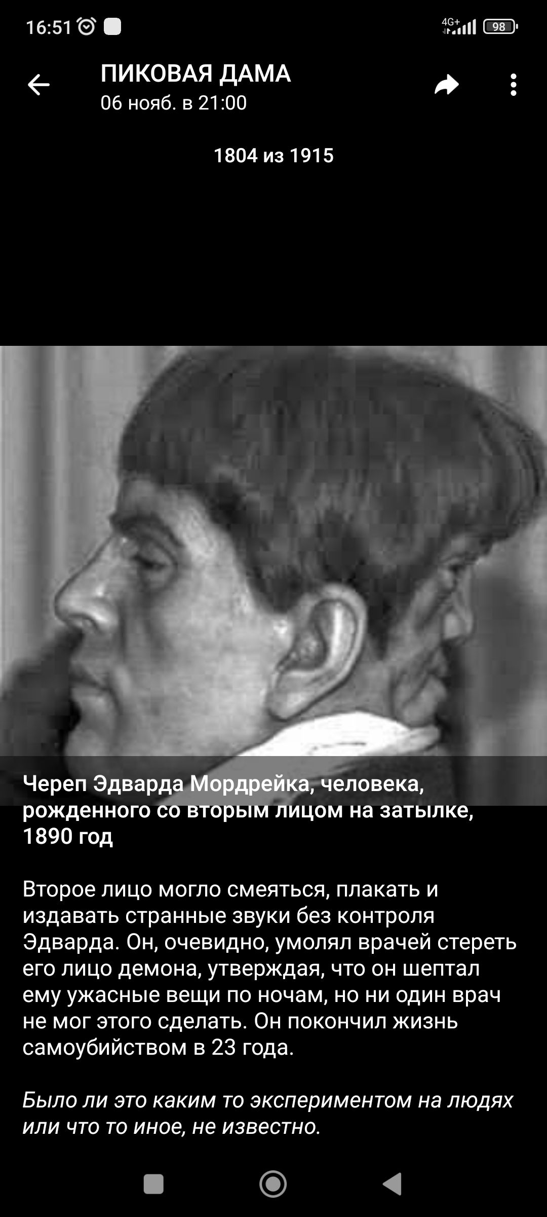 1651 ПИКОВАЯ ДАМА 06 нояб в 2100 1804 из 1915 Череп Эдда рожденного 1890 год Второе лицо могло смеяться плакать и издавать странные звуки без контроля Эдварда Он очевидно умолял врачей стереть его лицо демона утверждая что он шептал ему ужасные вещи по ночам но ни один врач не мог этого сделать Он покончил жизнь самоубийством в 23 года Было ли это каким то экспериментом на людях или что то иное не