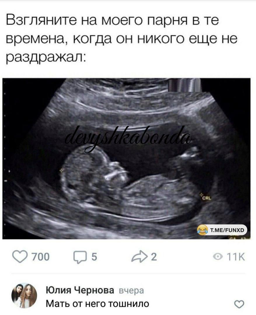 Взгляните на моего парня в те времена когда он никого еще не раздражал 700 л Юлия Чернова ч Мать ОТ НЕГО ТОШНИЛО