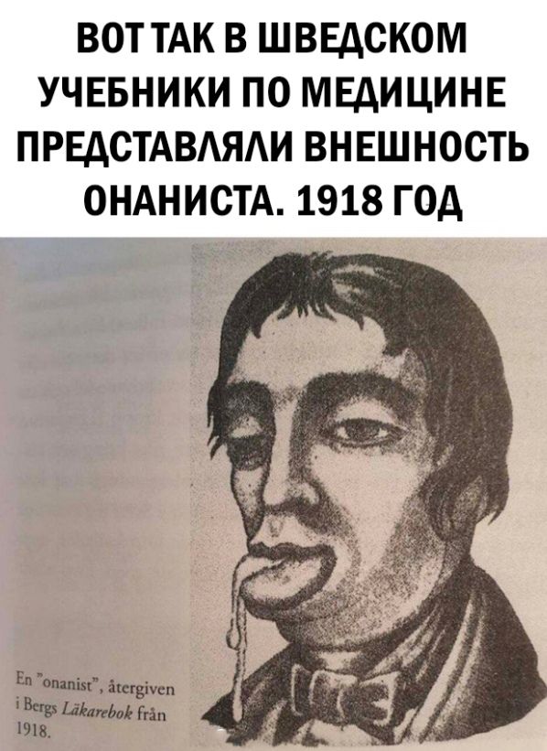 ВОТТАК В ШВЕДСКОМ УЧЕБНИКИ ПО МЕДИЦИНЕ ПРЕДСТАВЛЯЛИ ВНЕШНОСТЬ ОНАНИСТА 1918 ГОД