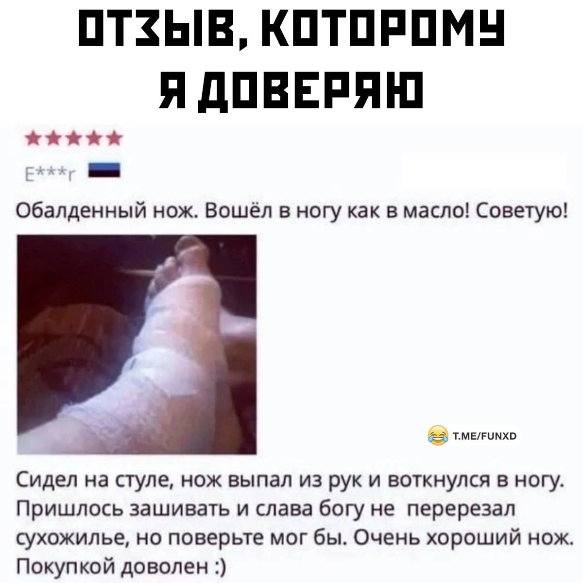 ПТЗЫВ КПТПРПМН Я дПВЕРЯі П _ Обалденный нож нашел в ногу как в масле Советую п Сидел на стуле нож выпал из рук и воткнулся в ногу Пришлось зашивать и тава богу не перерезал сухожилье но поверьте мог бы Очень хороший нож Покупкой доволен