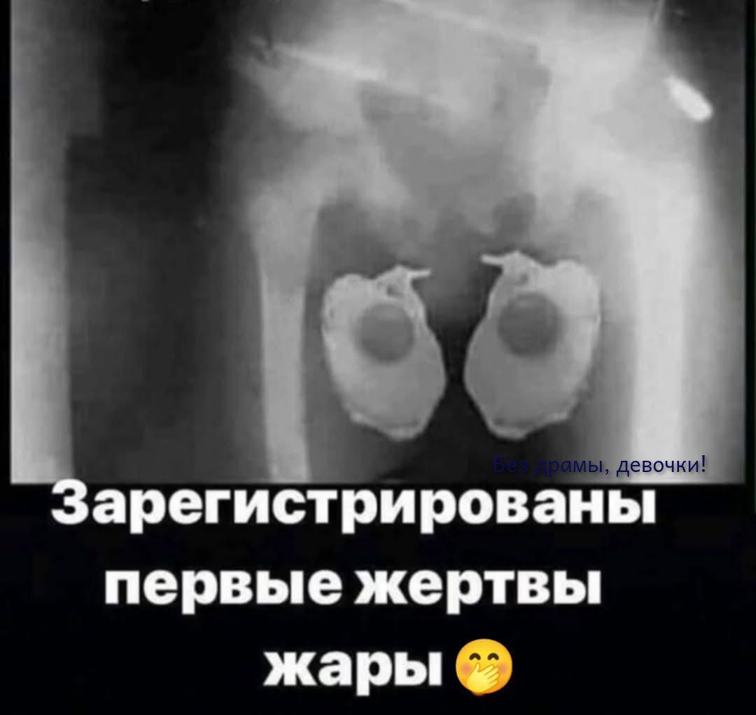 Зарегистрированы первые жертвы жары
