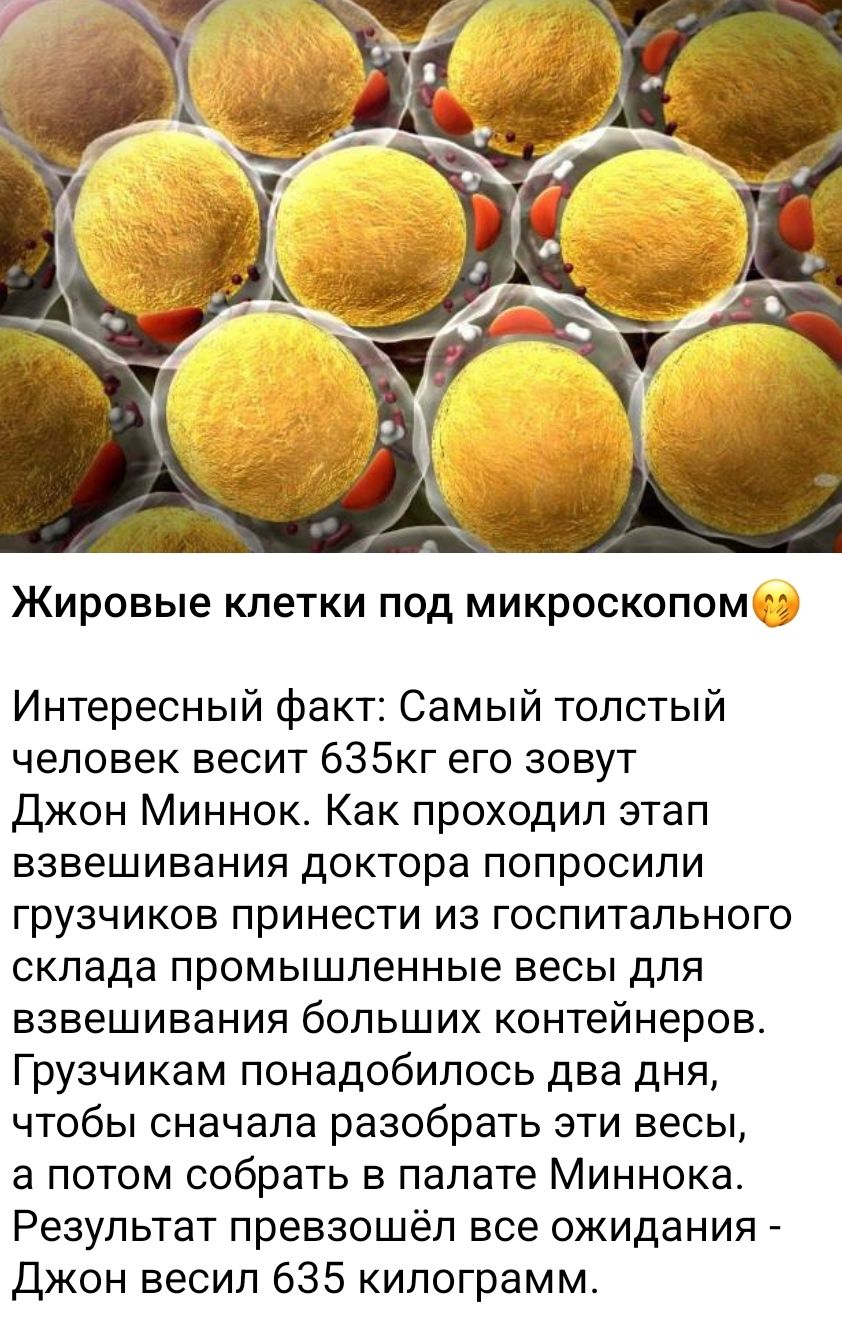 Жировые клетки под микроскопом

Интересный факт: Самый толстый человек весит 635кг его зовут Джон Миннок. Как проходил этап взвешивания доктора попросили грузчиков принести из госпитального склада промышленные весы для взвешивания больших контейнеров. Грузчикам понадобилось два дня, чтобы сначала разобрать эти весы, а потом собрать в палате Миннока. Результат превысил все ожидания - Джон весил 635 килограммов.