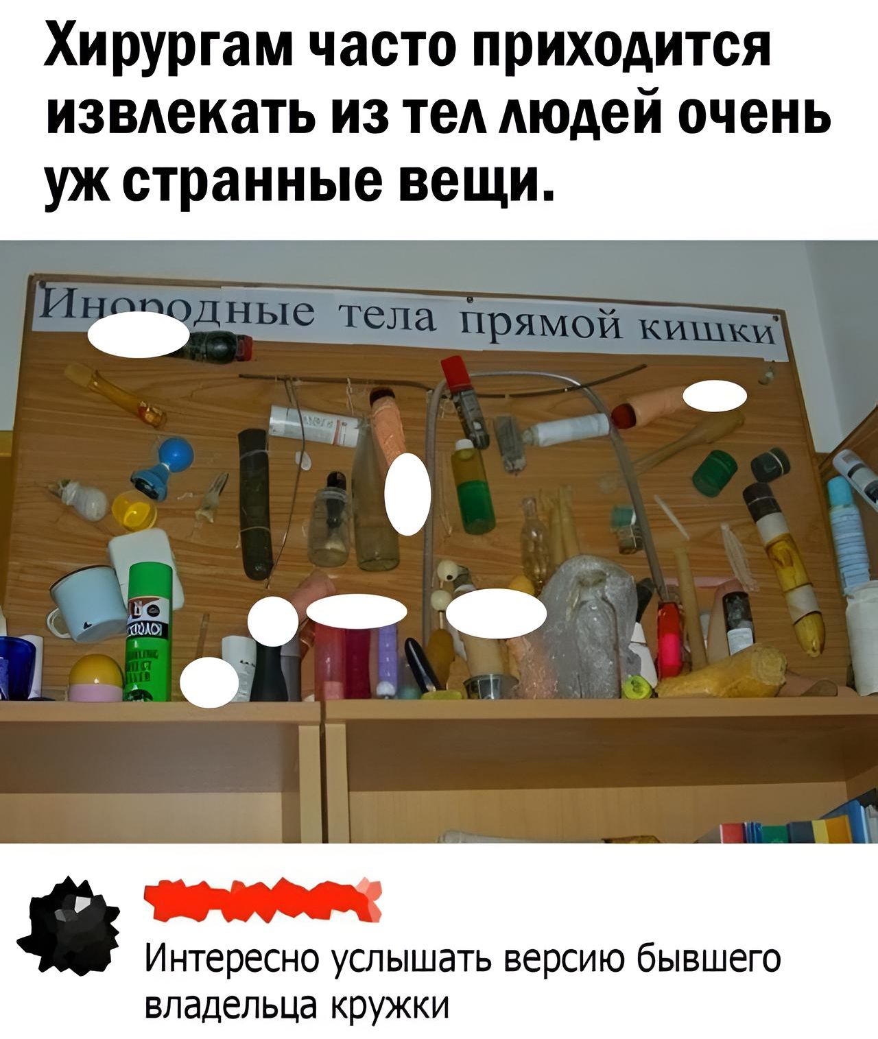 Хирургам часто приходится извлекать из тел людей очень УЖ странные ВЕЩИ Интересно услышать версию бывшего владельца кружки