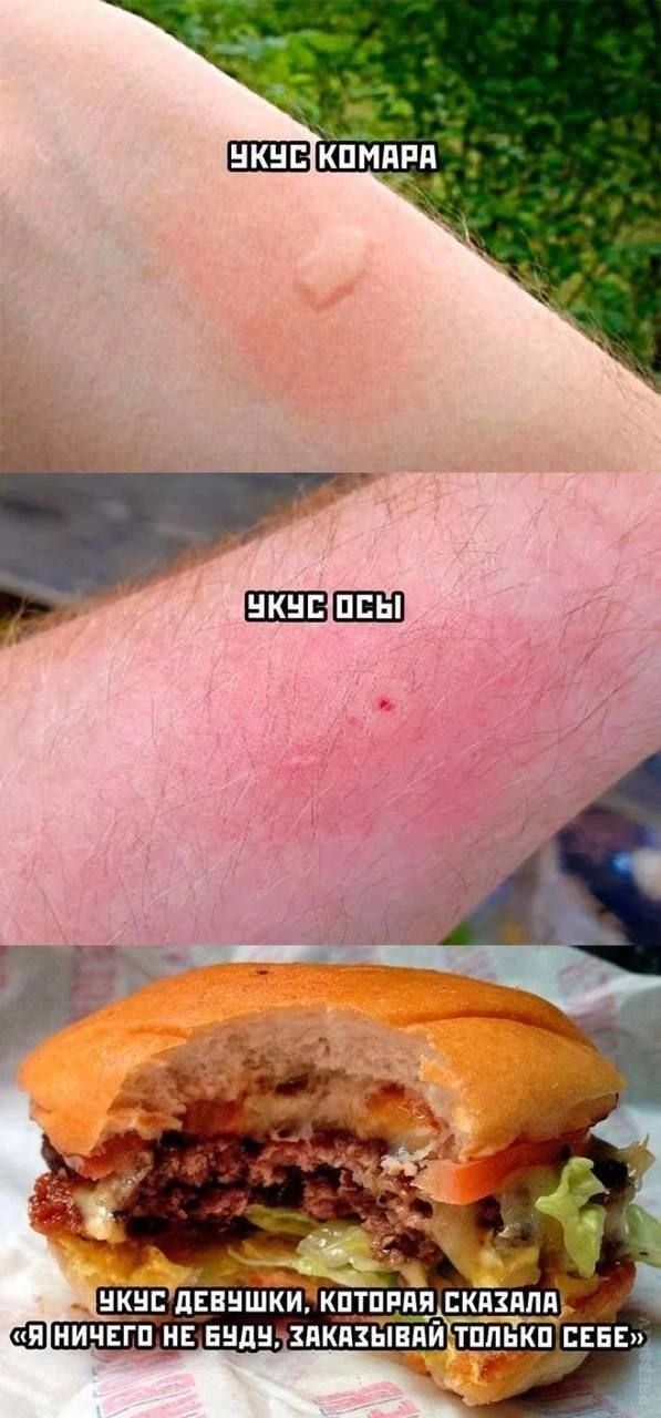 УКУС КОМАРА
УКУС ОСЫ
УКУС ДЕВУШКИ, КОТОРАЯ СКАЗАЛА «Я НИЧЕГО НЕ БУДУ, ЗАКАЗЫВАЙ ТОЛЬКО СЕБЕ»