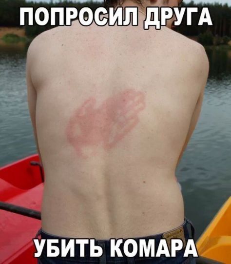 ПОПРОСИЛ ДРУГА УБИТЬ КОМАРА