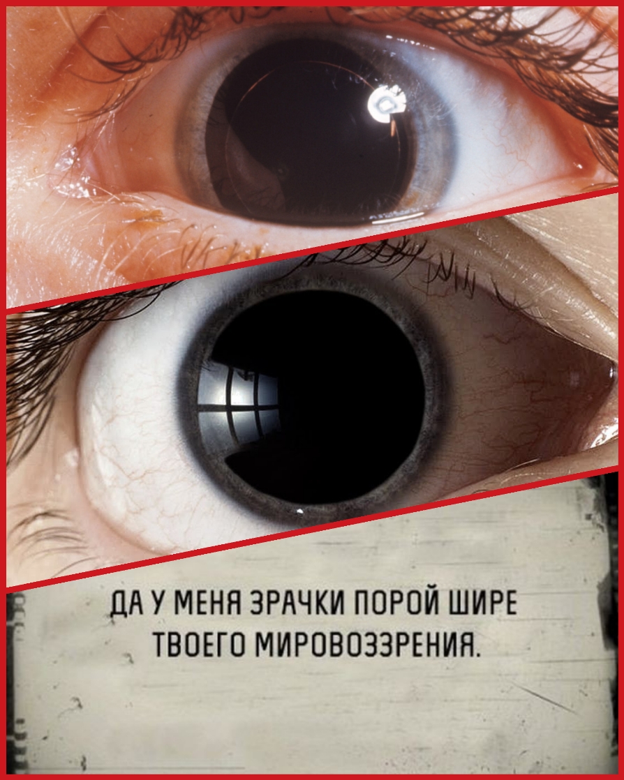 _ЦА У МЕНЯ ЗРАЧКИ ПОРОЙ ШИРЕ ТВОЕГО МИРОВОЗЗРЕНИЯ