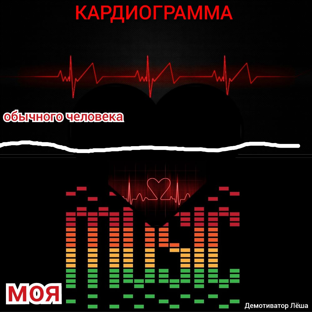 КАРДИОГРАМ МА _ _ _ _ _ _ _ _ _ _ _ _ ___ __ А _ _ __ ___ _ _ _ __ в А ___ _ _ _ __ __ _ _ _ __ __ _ _ _ __ __ _ _ _ __ ___ __ _ _ __ _ ___ _ __ _ __ _ _ __ _ __ _ _ __ _ __ _ _ __ __ ___ _ _ _ __ __ ___ _ _ _ _ _ _ _ _ _ _ _ _ _ _ _ _ _ _ _ _ _ _ _ _ Дем иватор Лёша