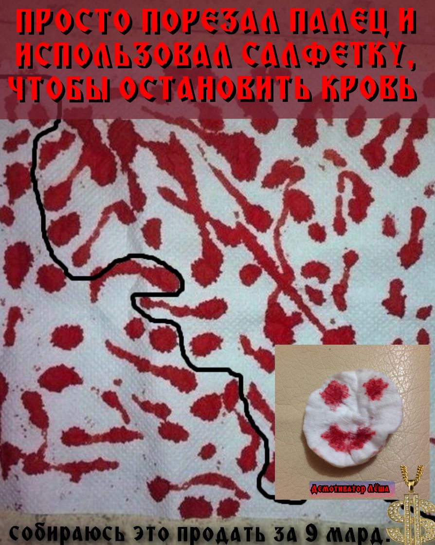 ПРОСТО ПОРЕЗАА ПААЁЦ И ИСПОЛЬЗОВАА СддфеТБУ ЧТОБЫ ОСТАНОВИТЬ КРОВЬ ___