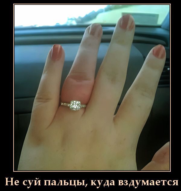 Не суй пальцы, куда вздумается