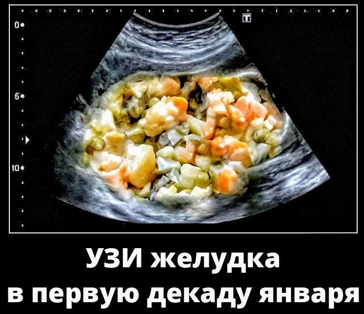 УЗИ желудка в первую декаду января