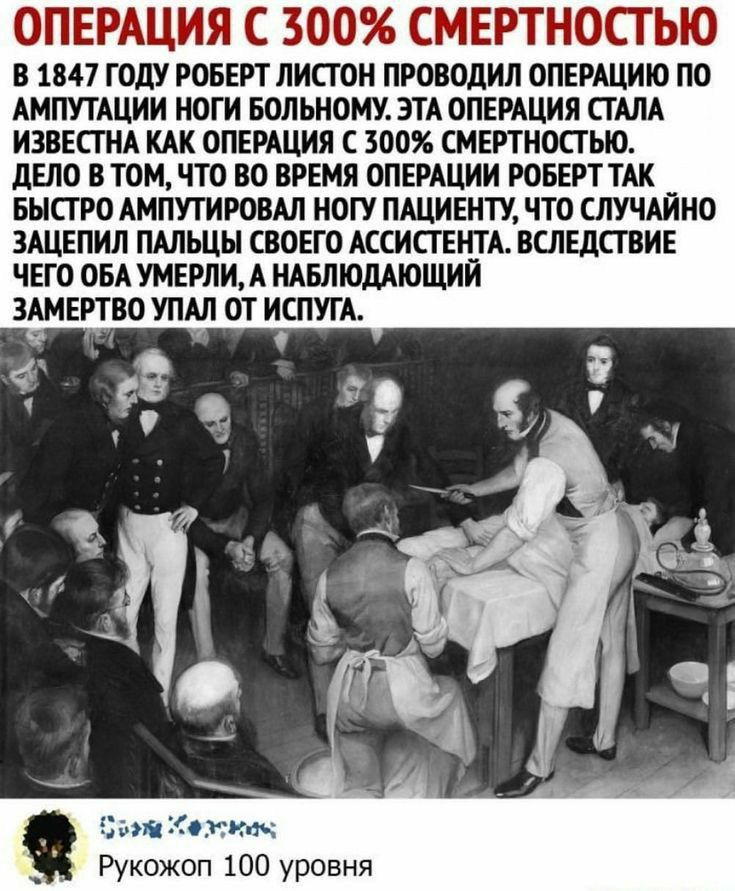 ОПЕРАЦИЯ С 300 СМЕРТНОСТЬЮ В 47 ГОДУ РОБЕРТ ЛИСТ ОН ПРОВОдИЛ ОПЕРАЦИЮ ПО АМПУТАЦИИ НОГИ БОЛЬИОМУ ЭТА ОПЕРАЦИЯ СТАЛА ИЗВЕПНА КАК ОПЕРАЦИЯ 300 СМЕРТНОСТЫО дЕЛО В ТОМ ЧТО ВО ВРЕМЯ ОПЕРАЦИИ РОБЕРТ ТАК _ БЫСТРО АМПУГИРОВАЛ НОГУ ПАЦИЕНТУ ЧТО СЛУЧАИИО ЗАЦЕПИЛ ПАПЩЫ СВОЕГО АССИПЕНТА БШЕДШИЕ ЧЕГО ОБА УМЕРПИ А НАБЛЮЛАЮЩИИ ЗАМЕРТВО УПАЛ ОТ ИСПУГА Рукожоп 100 уровня