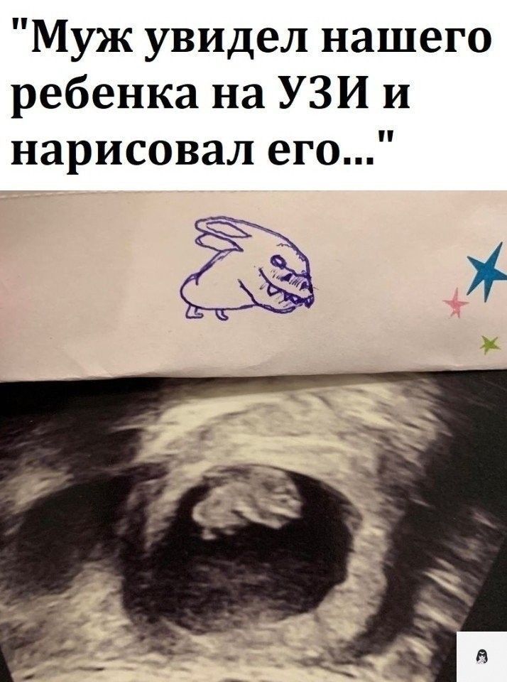 Муж увидел нашего ребенка на УЗИ и нарисовал его