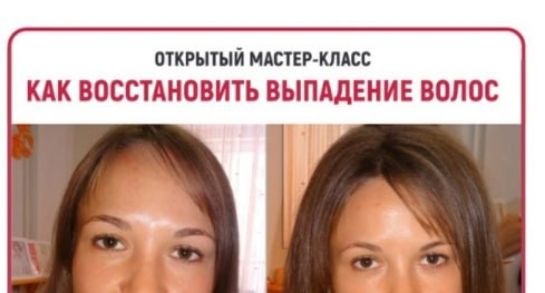 вшитый ищи км КАК ВОССТАНОВИТЬ ВЫПАДЕНИЕ ВОЛОС