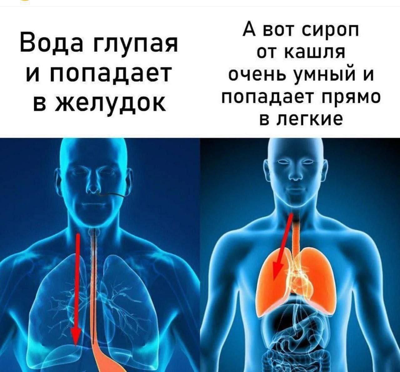 А вот сироп Вода глупая от кашля и попадает очень умный и в жепудОК попадает прямо в легкие