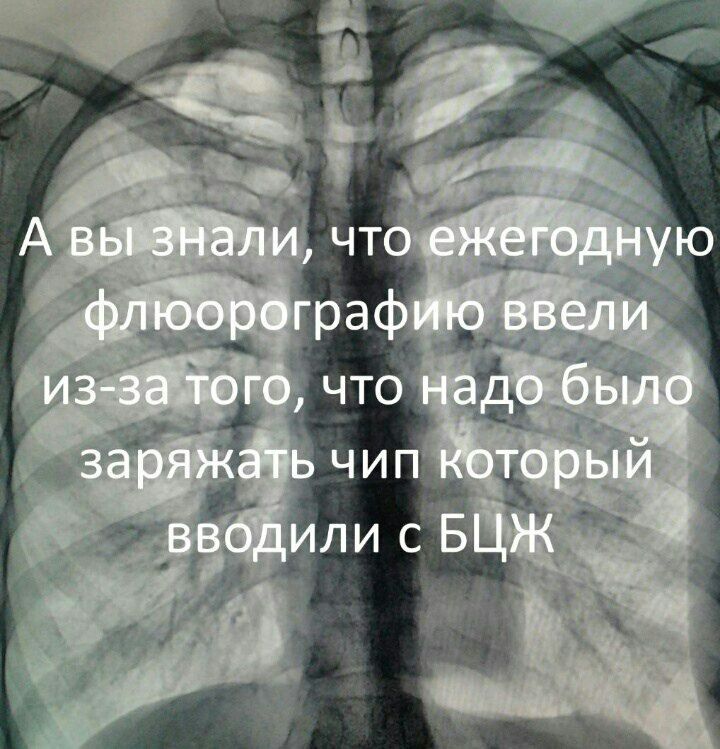 А вы знали, что ежегодную флюорографию ввели из-за того, что надо было заряжать чип который вводили с БЦЖ