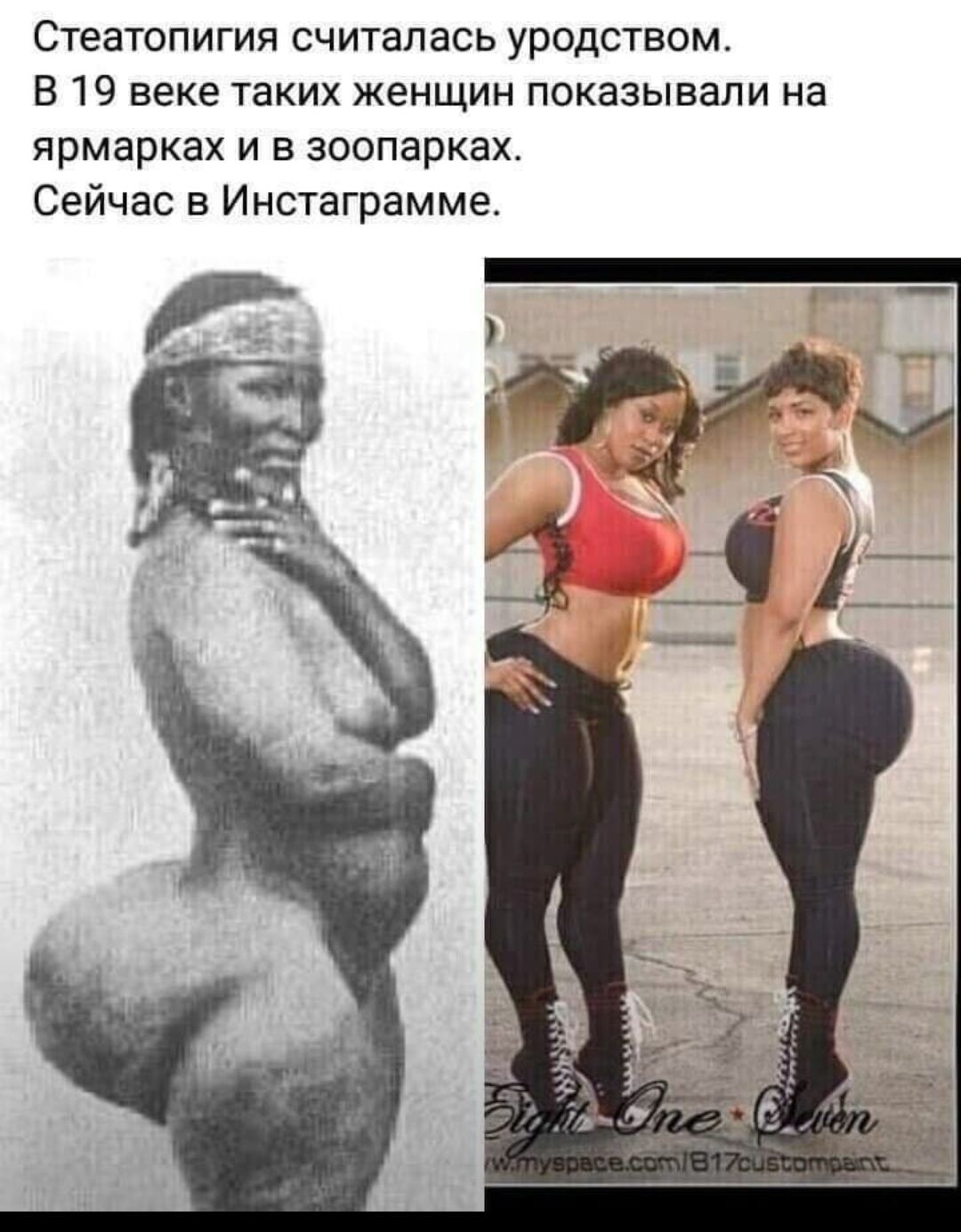 Стеатопигия считалась уродством В 19 веке таких женщин показывали на ярмарках и в зоопарках Сейчас Инстаграмме