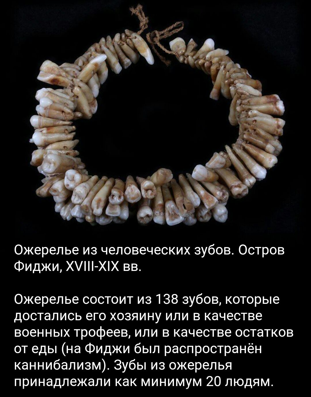 Ожерелье из человеческих зубое Остров Фиджи Х ХХ вв Ожерелье состоит из 138 зубов которые ДОСТВЛИСЬ ЕГО ХОЗЯИНУ или 5 качестве ВОЕННЫХ трофеев или В качестве остатков от еды на Фиджи был распространён каннибализм Зубы из ожерелья принадлежали КНК МИНИМУМ 20 ЛЮДЯМ