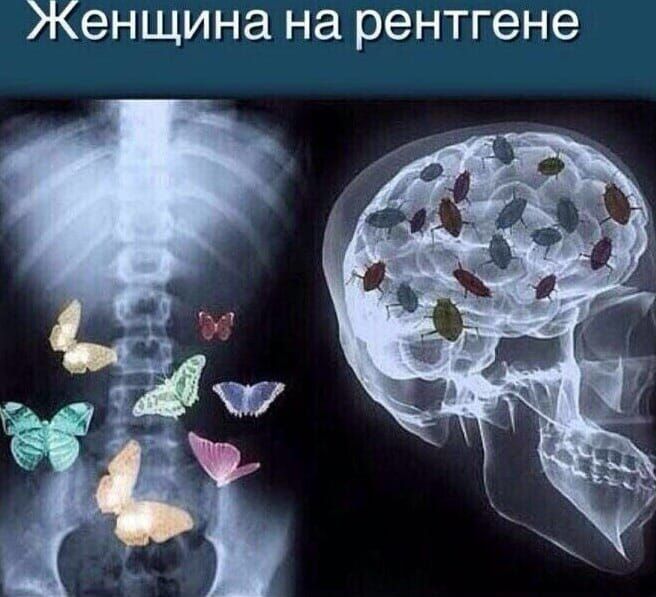 Женщина на рентгене