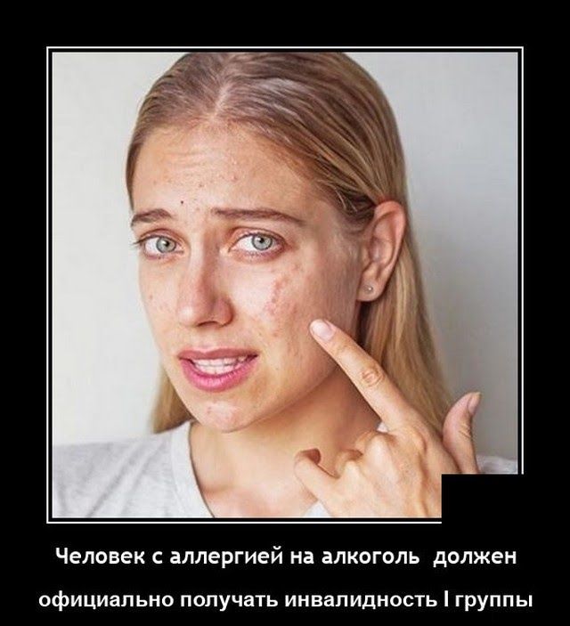 Человек іплергией на алкоголь должен официально получать инвалидность группы