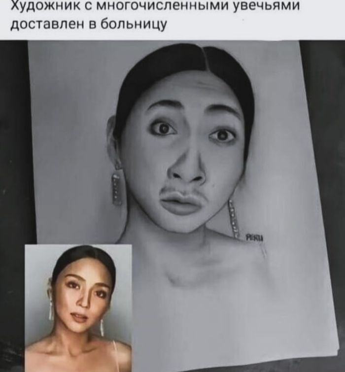 хлудожник с многочисленными увечьями доставлен в больницу