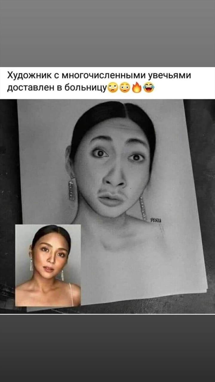 Художник многочисленными увечьями доставлен в больницу _