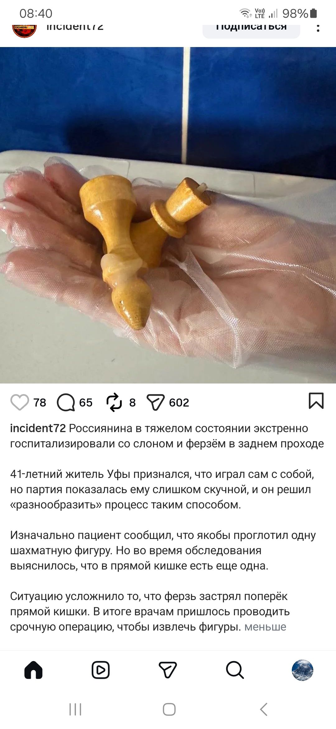 Россиянина в тяжелом состоянии экстренно госпитализировали со слоном и ферзём в заднем проходе. 41-летний житель Уфы признался, что играл сам с собой, но партия показалась ему слишком скучной, и он решил «разнообразить» процесс таким способом. Изначально пациент сообщил, что якобы проглотил одну шахматную фигуру. Но во время обследования выяснилось, что в прямой кишке есть еще одна. Ситуацию усложнило то, что ферзь застрял поперёк прямой кишки. В итоге врачам пришлось проводить срочную операцию, чтобы извлечь фигуры.