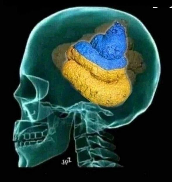 Крупный рентген головы с ярко раскрашенным мозгом в сине-жёлтых цветах, выглядит как мемная иллюстрация.