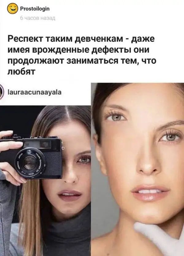 гюнощкп Респект таким девченкам даже имея врожденные дефекты ОНИ продолжают заниматься тем ЧТО любят аигаасппаауаа