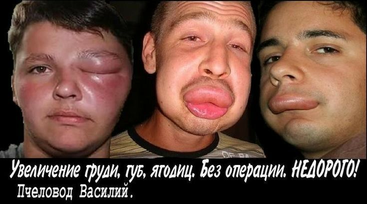 7 А _ Увеличение рули гуд ягодиц Без операции могоо Пчеловод Василий