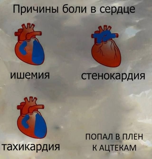 Причины боли в сердце ишемия стенокардия тахикардия попал в плен к ацтекам