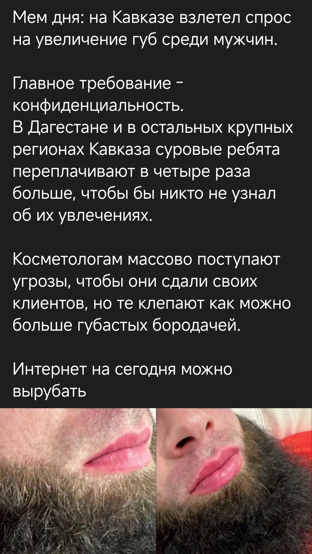 Мем дня: на Кавказе взлетел спрос на увеличение губ среди мужчин.

Главное требование – конфиденциальность.
В Дагестане и в остальных крупных регионах Кавказа суровые ребята переплачивают в четыре раза больше, чтобы бы никто не узнал об их увлечениях.

Косметологам массово поступают угрозы, чтобы они сдали своих клиентов, но те клеят как можно больше гутных бородачей.

Интернет на сегодня можно вырубать.