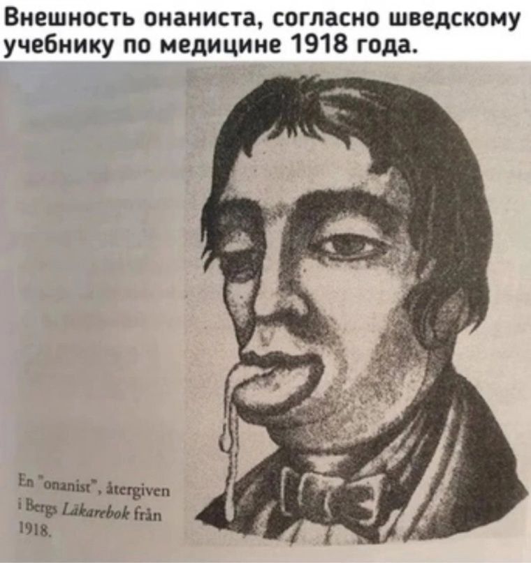 Внешность онониста, согласно шведскому учебнику по медицине 1918 года.