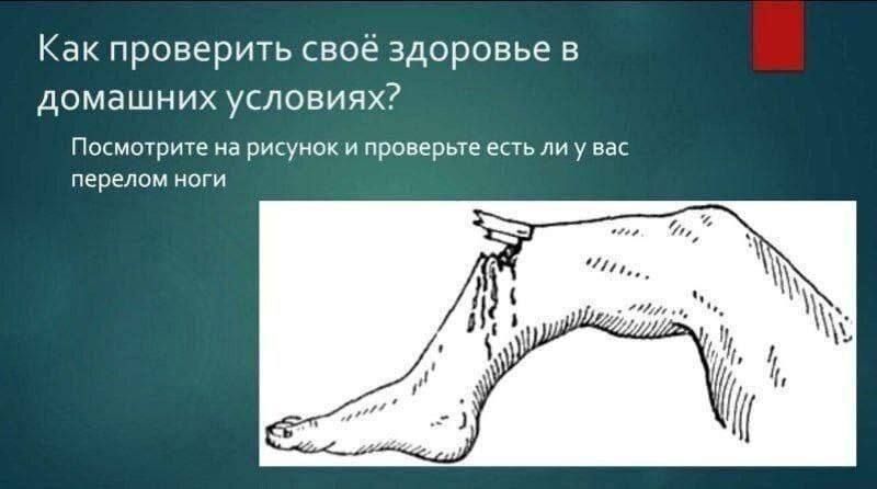 Как проверить своё здоровье в домашних условиях?
Посмотрите на рисунок и проверьте есть ли у вас перелом ноги.